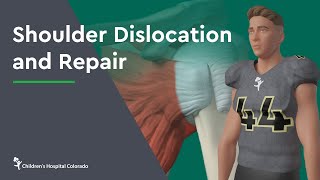 How to Treat a Dislocated Shoulder [upl. by Damalas827]