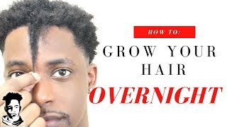 How To Grow Your Hair OVERNIGHT  WINSTONEE [upl. by Hawkins537]