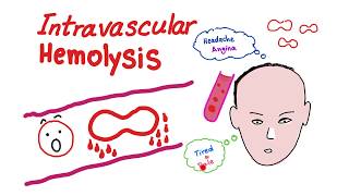 Intravascular Hemolysis [upl. by Elisabetta]