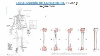 Clasificación de las Fracturas [upl. by Dranoc]