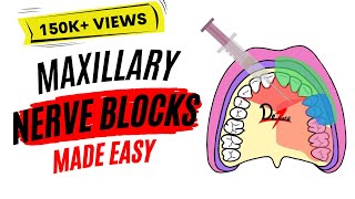 Maxillary Nerve Block Anesthesia For Dental Procedures [upl. by Tehcac]