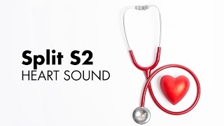 Fixed Split S2  Heart Sounds  MEDZCOOL [upl. by Salahcin]