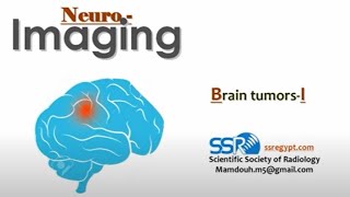 Brain tumors Imaging I DRE  Prof Mamdouh Mahfouz [upl. by Thad444]