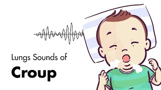 Sounds of Croup Laryngotracheitis  Lung Sounds  MEDZCOOL [upl. by Suivatnad777]