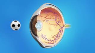 CATARACT SURGERY FACTS amp MYTHS Frequently asked questions about cataract surgery [upl. by Adniles]