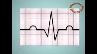 Understanding ECGs  EKG [upl. by Rebah337]