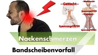 NACKENSCHMERZEN amp HWS Bandscheibenvorfall  Symptome Ursachen amp Lösungen [upl. by Akinahc774]