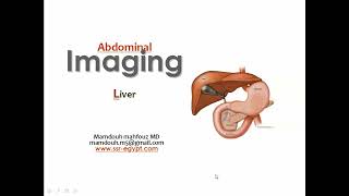 Hepatic imaging DRE Prof Mamdouh Mahfouz [upl. by Anahtor]