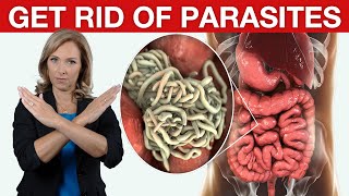 9 Tips to Get Rid of Parasites amp Candida  Dr Janine [upl. by Maxy]