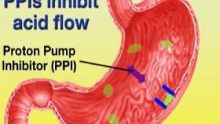 Esomeprazole Nexium [upl. by Schwitzer]