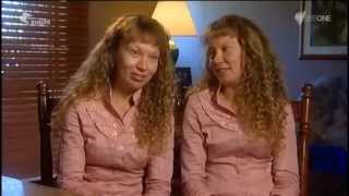 These Twins Were Named quotThe Most Beautiful Twins In The Worldquot [upl. by Christiana293]