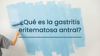 ¿Qué es la Gastritis eritematosa antral [upl. by Adal]