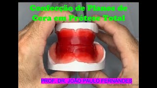 9  Plano de cera para Prótese Total [upl. by Photima224]