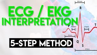 ECG Interpretation Made Easy  ECG EKG Interpretation Part 2 [upl. by Guidotti]