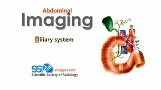 Biliary imaging DRE Prof Mamdouh Mahfouz [upl. by Anelas]