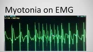 Autosomal Dominant Diseases Song  USMLE Mnemonic [upl. by Dett]