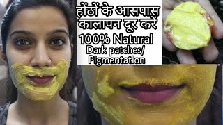 How To Remove Dark Black PatchesDark Spots Pigmentation Around Mouth Area  Super Style Tips [upl. by Mayer]