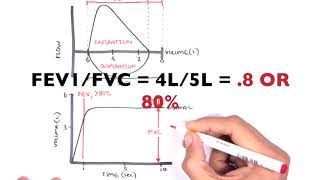 What Does Spirometry Measure TMC Practice Question  Respiratory Therapy Zone [upl. by Draillih]