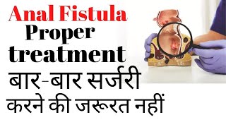 Fistula ka best treatment kya hai [upl. by Eugor523]