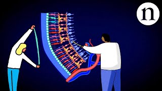 Retinal repair Bringing stem cells into focus [upl. by Ainotal]