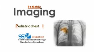 Pediatric chest imaging I DRE Prof Mamdouh Mahfouz [upl. by Minta931]