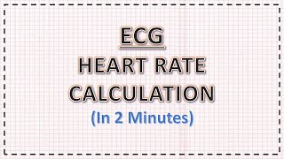 Intro to EKG Interpretation  Waveforms Segments and Intervals [upl. by Havot]