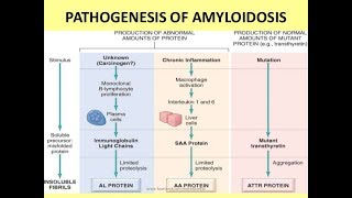 What is AL amyloidosis [upl. by Yorker]