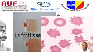 MORPHOLOGIE EN HEMATOLOGIE EPISODE 2 [upl. by Ylus]