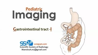 Pediatric GIT imaging I DRE Prof Mamdouh Mahfouz [upl. by Mairim431]