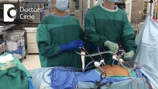 Dos amp Donts after Gynaecologic Laparoscopic Surgeries  Dr Shafalika Boriah [upl. by Avat]