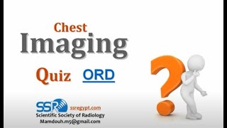 Quiz Chest DRE  Prof Mamdouh Mahfouz [upl. by Arlyn]