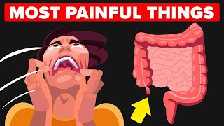 Most Painful Things a Human Can Experience 4 [upl. by Hadnama]