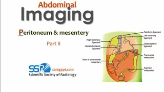 Mesentric imaging DRE Prof Mamdouh Mahfouz [upl. by Refinnaj]