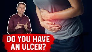 Understanding Ulcers How Do You Know If You Have One – Dr Berg [upl. by Grand]