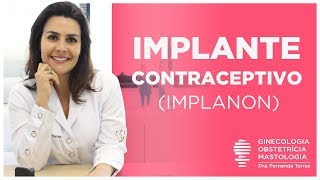 IMPLANON o Implante Anticoncepcional 🚺 Vídeo completo [upl. by Nnylatsirk]