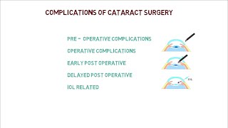 What to Expect After Cataract Surgery  Milan Eye Center [upl. by Lupiv]