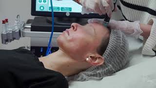 Hydrafacial  la séance complète de nettoyage de peau [upl. by Iroc]