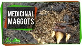 Marvelous Medicinal Maggots [upl. by Salta592]