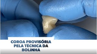 Coroa provisória posterior pela técnica da bolinha [upl. by Paehpos]