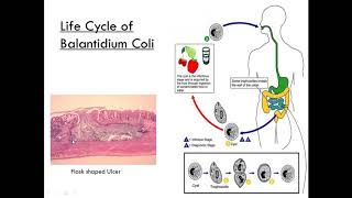 Balantidium Coli Class Ciliate Parasitology [upl. by Iverson354]