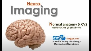 Normal Brain anatomy amp CVS DRE  Prof Mamdouh Mahfouz [upl. by Dodd]