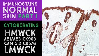 Immunohistochemistry in Normal Skin Cytokeratins [upl. by Kloman]