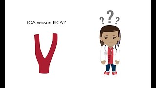 Distinguishing the ICA from the ECA with ultrasound [upl. by Care]