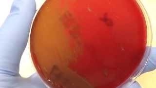 Microbiology  Hemolysis [upl. by Correy]