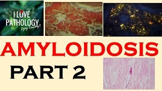 AMYLOIDOSIS Part 1 Definition Historical aspects amp Properties of Amyloid [upl. by Rehpretsirhc]