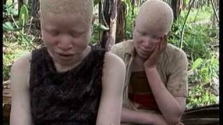 Deadly Hunt Albinos in Tanzania [upl. by Ewen336]